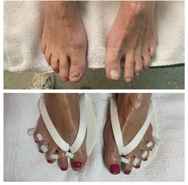 Medical pedicure deals near me